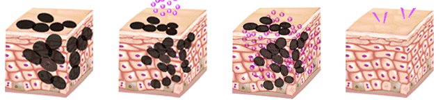 从现在开始，唯诺雅教你不做一“斑”女人