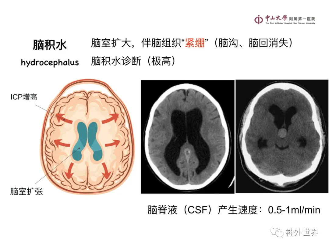 最全影像总结 | 颅内病变 MR、CT 的阅片技巧，太赞了