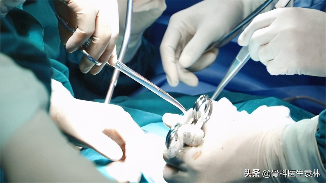 膝关节疼痛老化到底是怎么回事 膝关节老化应该怎么办 膝关节老化