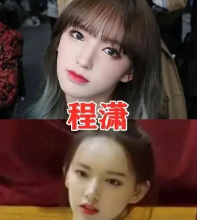 有种反差叫掀开刘海，杨幂发际线后移，看到l