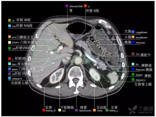掌握这篇解剖，晋级腹部CT影像诊断高手（精细版）