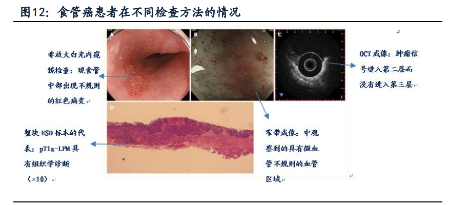 南微医学专题研究：另辟蹊径，成就消化内镜领军企业