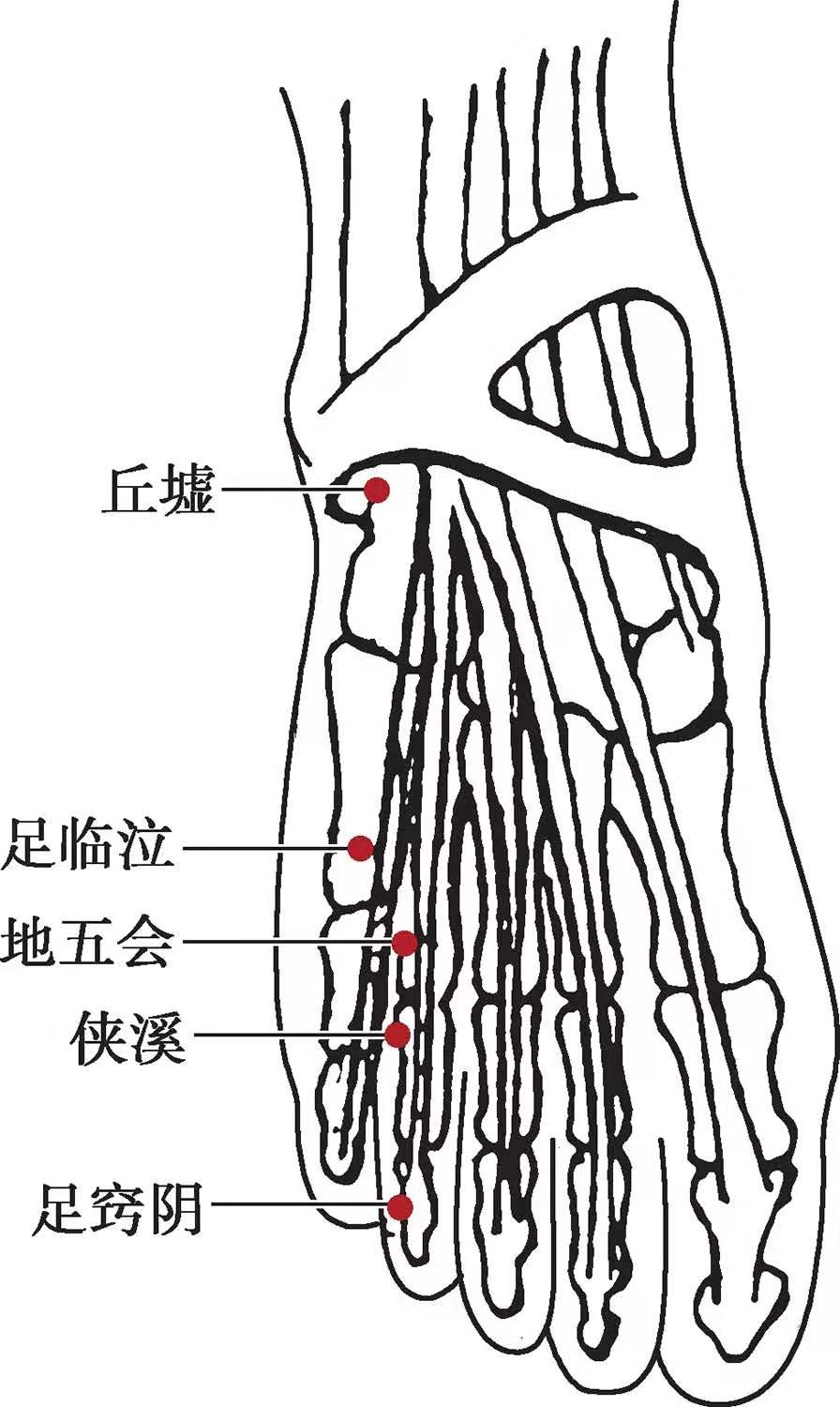 清热解毒消肿类阳谷侠溪