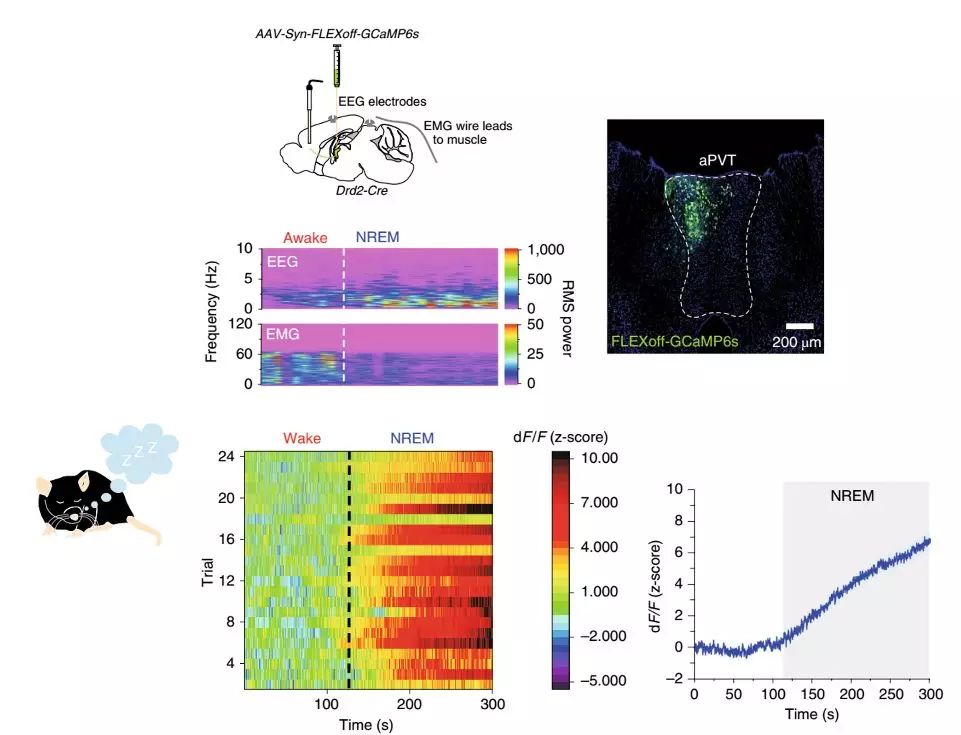 微小腦區的精確再細分