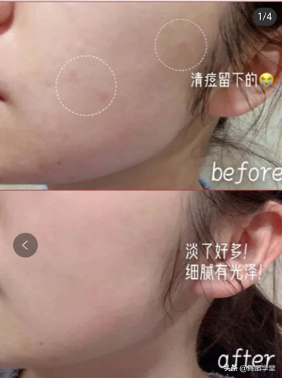 章子怡素颜曝光，这和普通人有什么区别？网友