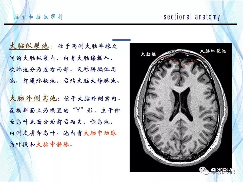 超全详解：脑池和脑室断层解剖