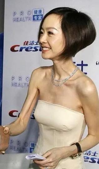 瘦成“纸片人”的5位明星，各有各的辛酸，混娱乐圈怎么那么难