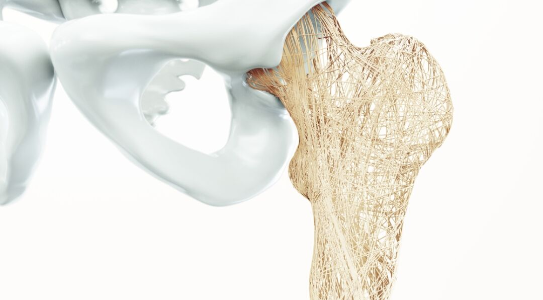 预防骨质疏松，不只补钙这么简单