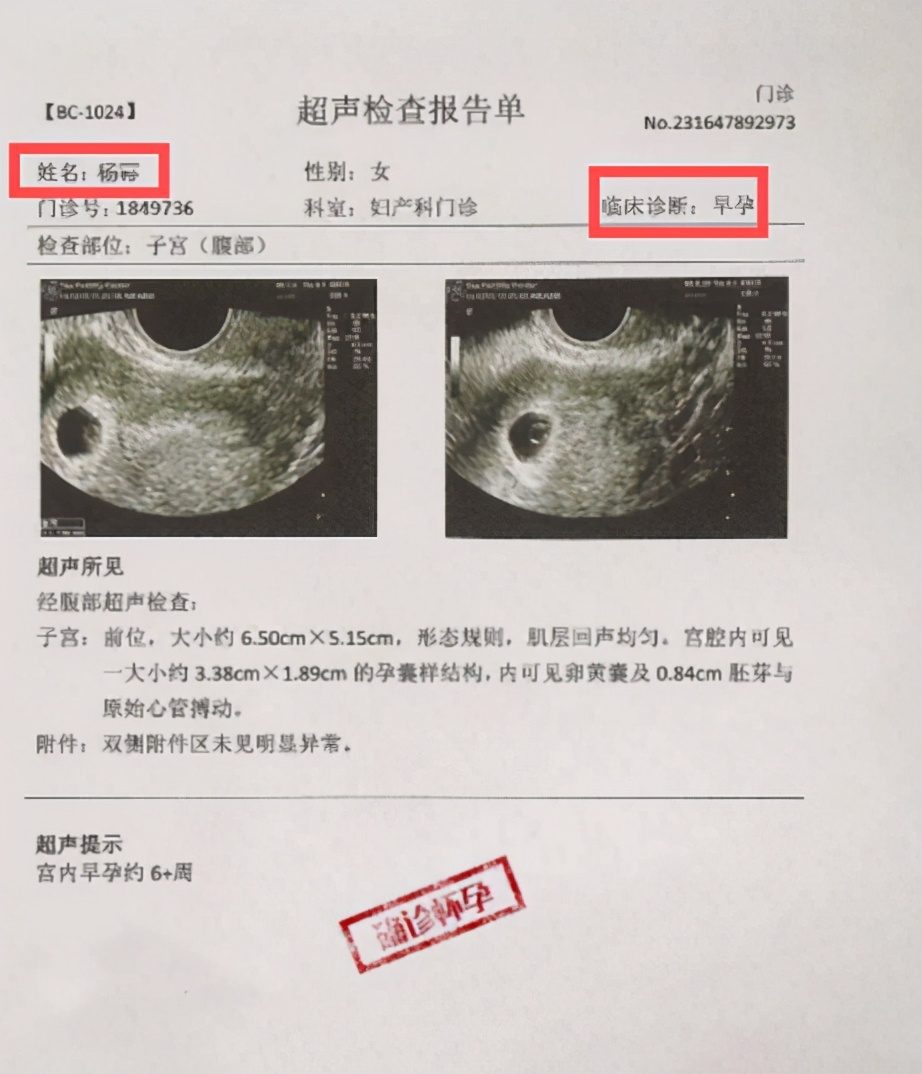 杨幂被传再婚且已怀孕，B超单在网上疯传，本人