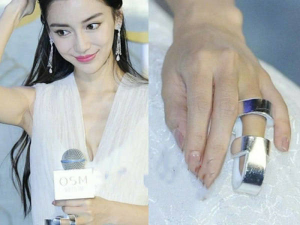 明星参加综艺有多危险？杨颖骨折，  李晨医院