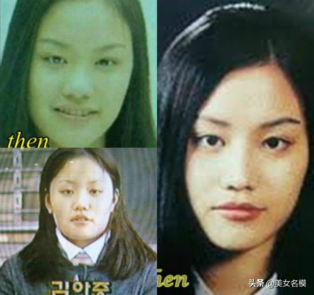 大方承認整容，卻依舊被奉為女神的5位女星