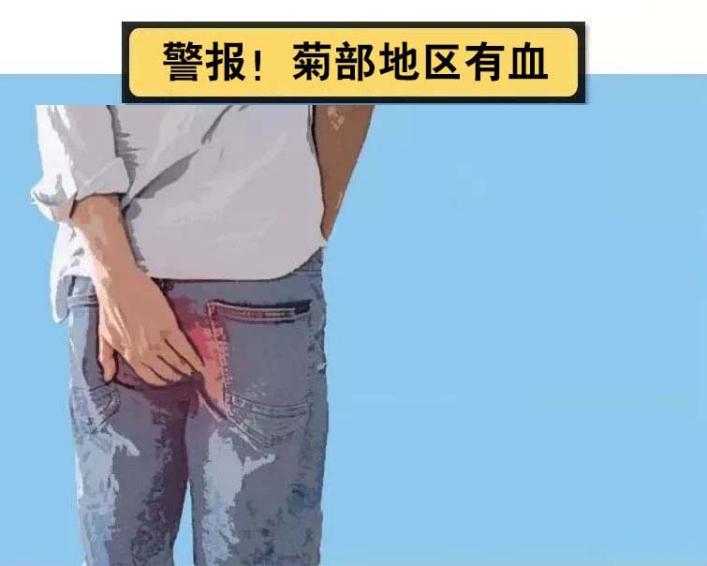 菊情战略局新闻发布会之应对痔疮疫情