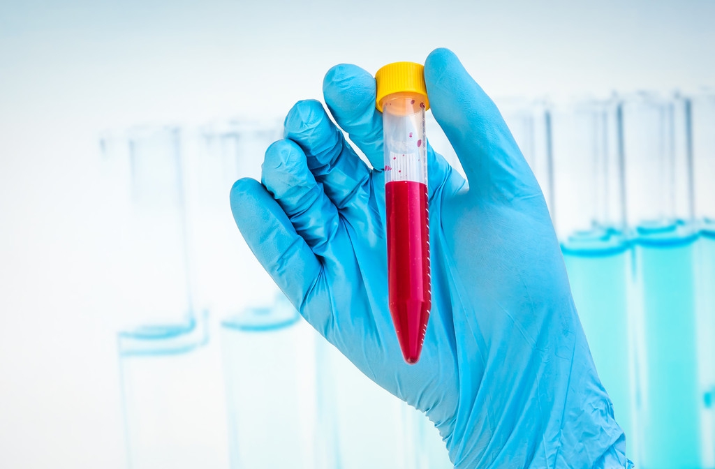 新冠肺炎检测常态化，核酸检测需求量很大，相