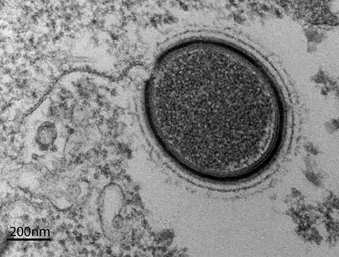 北极发现5.7万年前尸体，科学家担心有更危险东西-第6张图片-大千世界