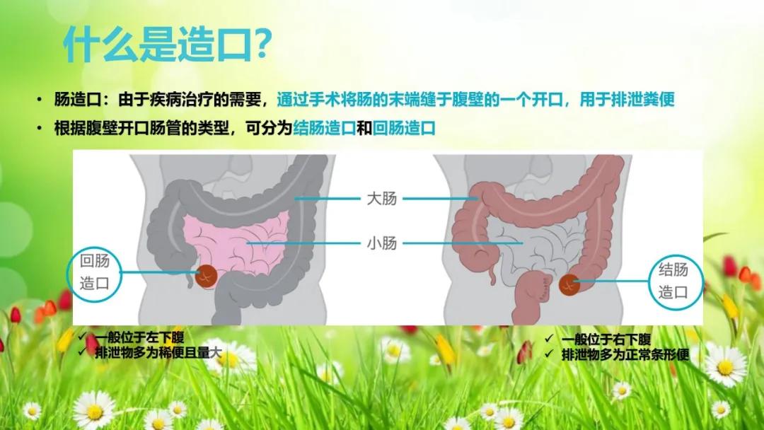 健康科普大赛获奖作品展示⑦丨肠造口术后患者健康教育