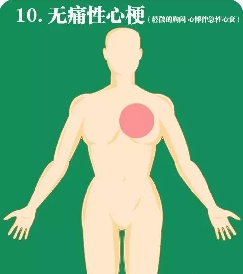11.20心梗救治日丨咸阳市第一人民医院在行动