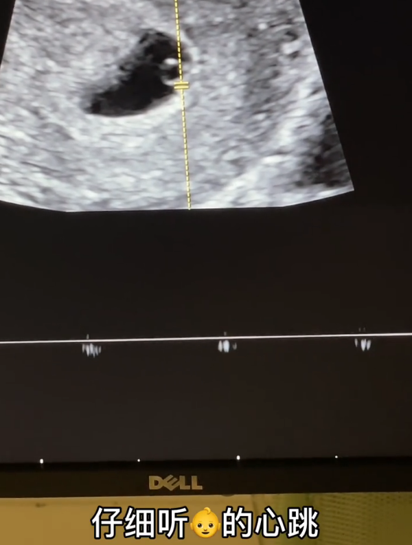 Piggy gentleman basks in child B to exceed, bag excited to weep, han Anran's word too firm