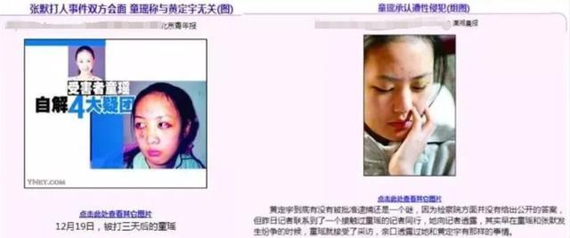 被前男友暴打、星途黯淡多年，“美强惨”女星