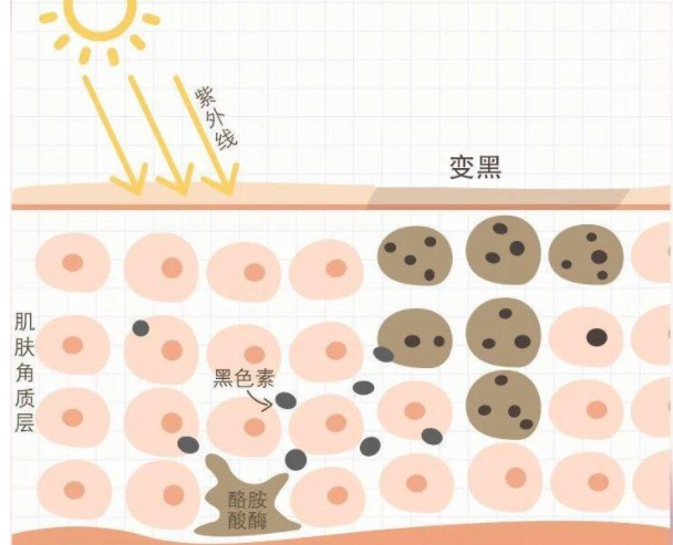 为什么你就是白不起来？这份“高效美白”攻略，学会了想不白都难