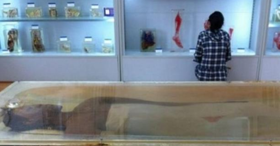 世界第一女巨人曾金莲：14岁高过姚明，18岁猝死，遗体至今未下葬