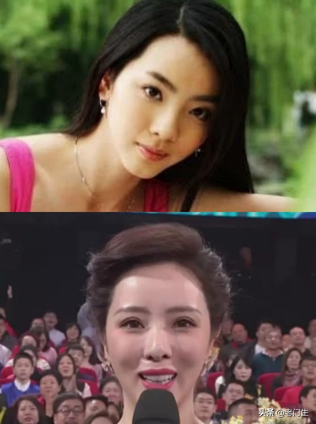 到底李思思整容整了哪些地方？她的容貌都有哪些改变？