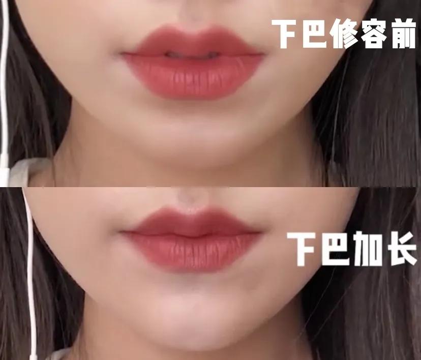 你是“斩男脸”还是“土气脸”？关键看这3点