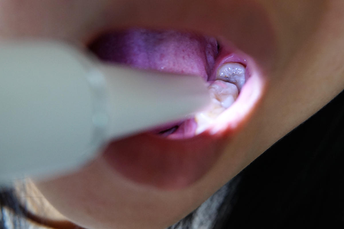 500W像素高精内窥镜，素诺可视洁牙仪的可玩性很高