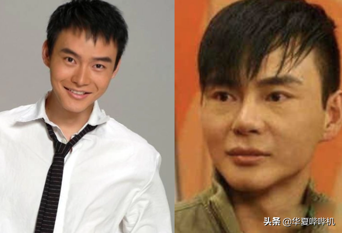 明星大型“翻车”现场，她们是如何整容变毁容