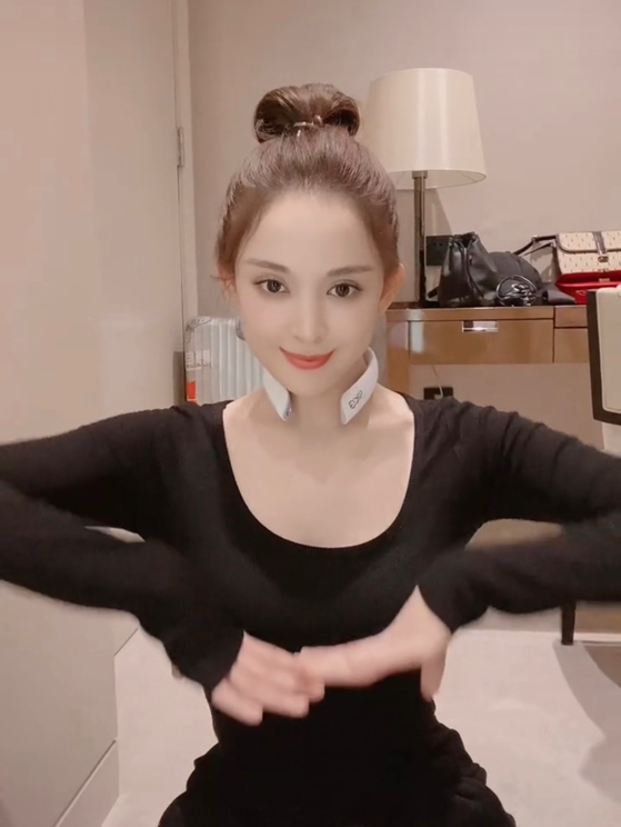 28岁娜扎穿紧身衣秀好身材，手臂细得像竹竿，发际线后移拖后腿