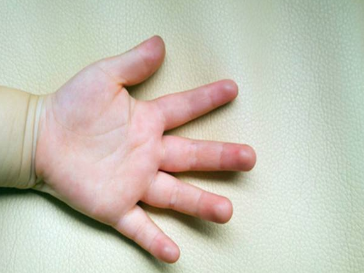 要想知道孩子智商如何，看他的“手”就能知道一二，家长不妨看看
