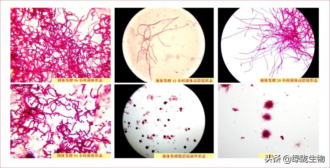 微生物菌有多强大，种植、水产、养殖都离不开它！（一）