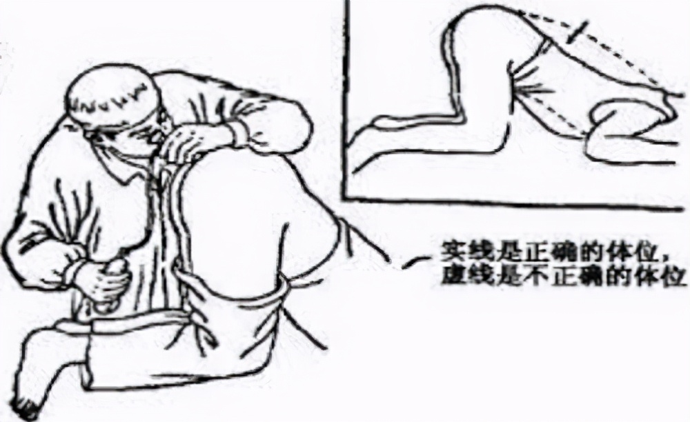 讓日本人求饒的肛拭子檢測，中國人都不忍直視