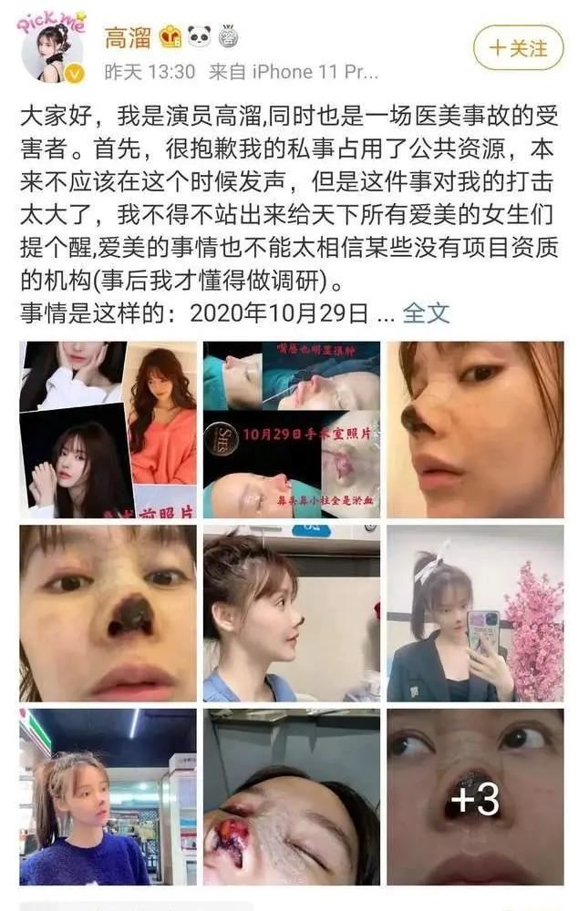 女演员自曝整形失败,涉事医美机构一年内被罚5次
