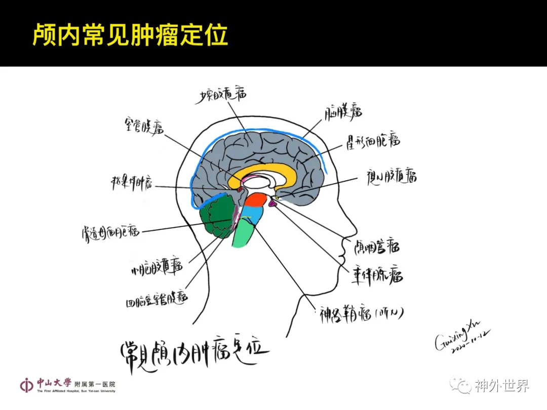最全影像总结 | 颅内病变 MR、CT 的阅片技巧，太赞了