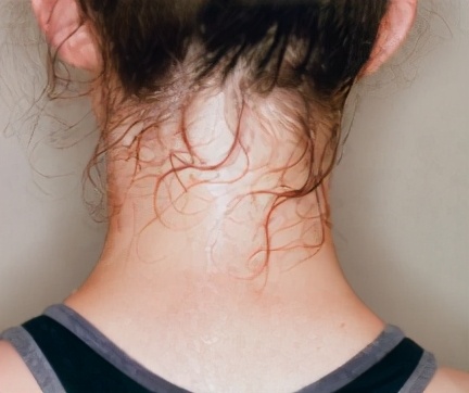 濕氣重的人，晨起後會有3個表現，祛除濕氣，做好這幾步