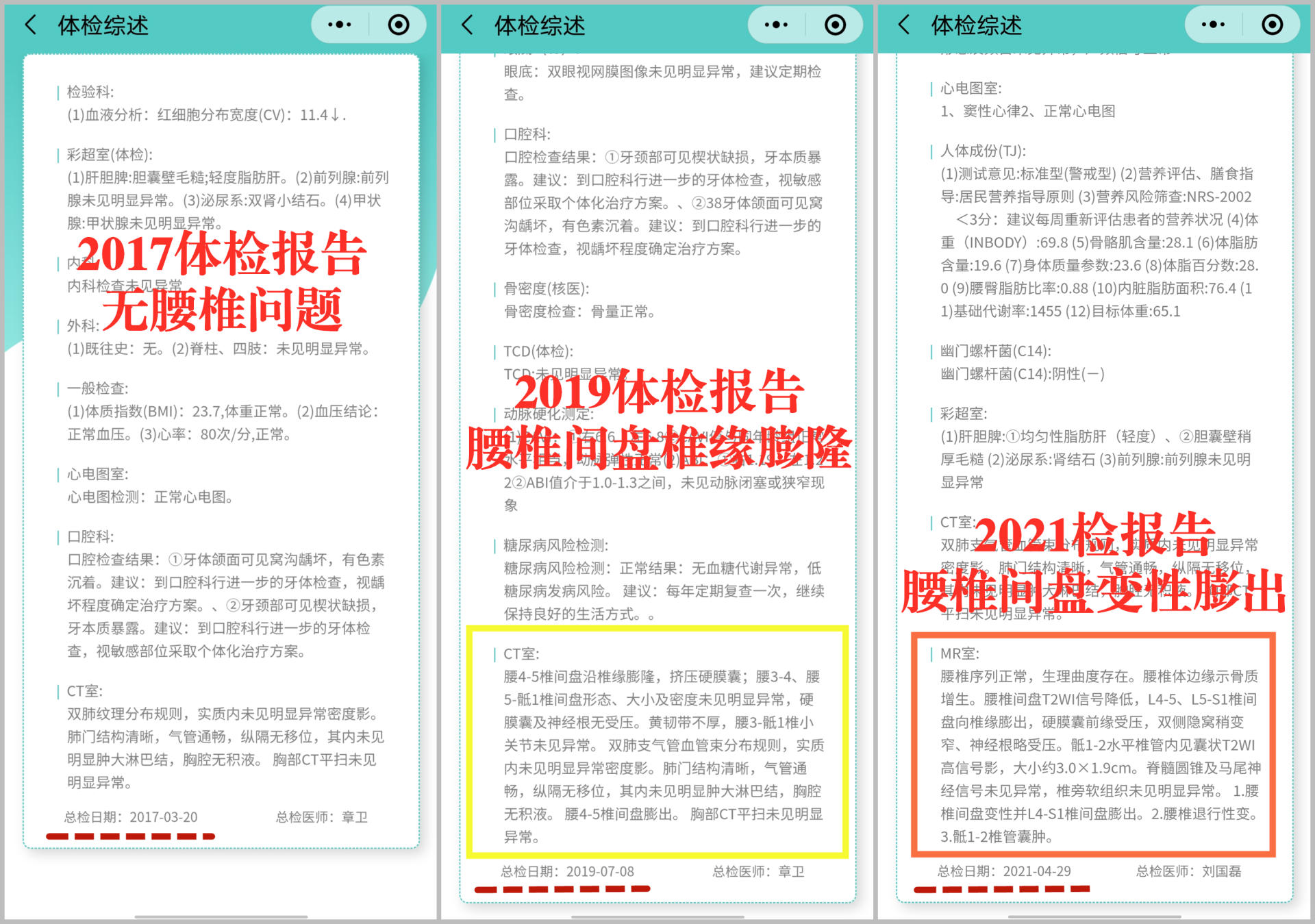 諾泰護腰帶，給你撐腰，也是提醒