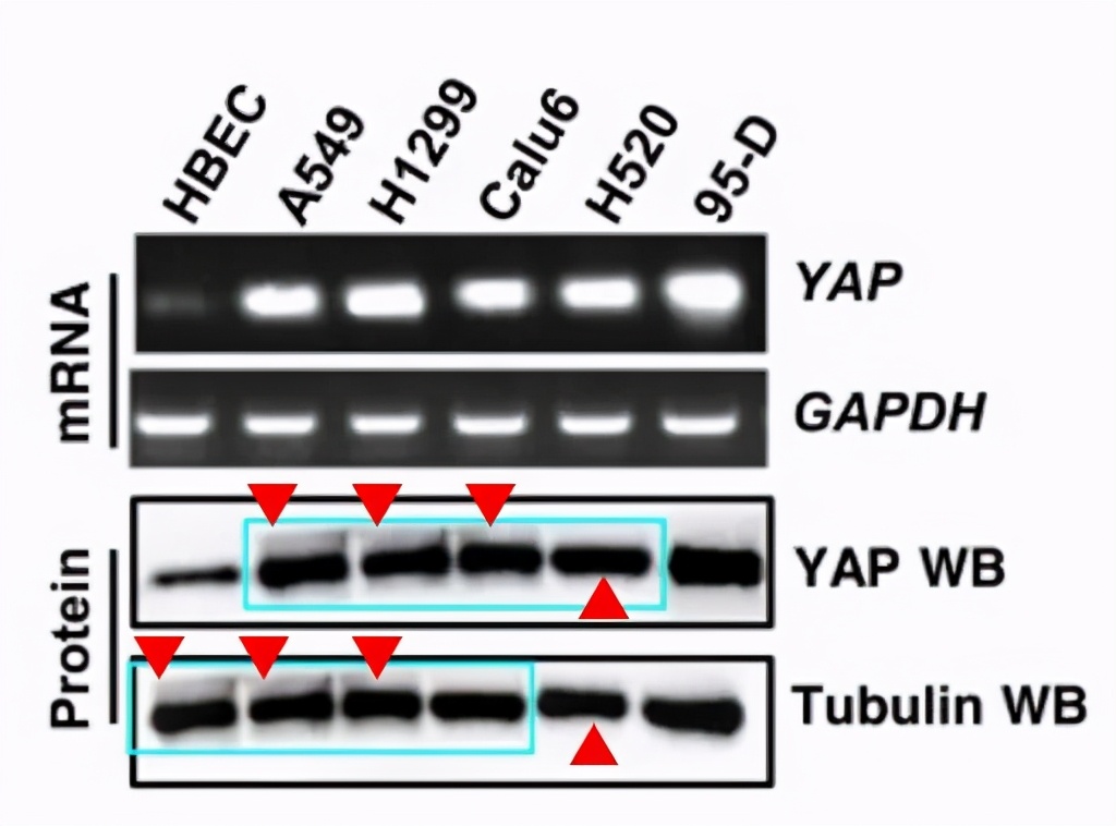 山东滨州医学院附属医院11篇SCI文章"挂榜"PubPeer