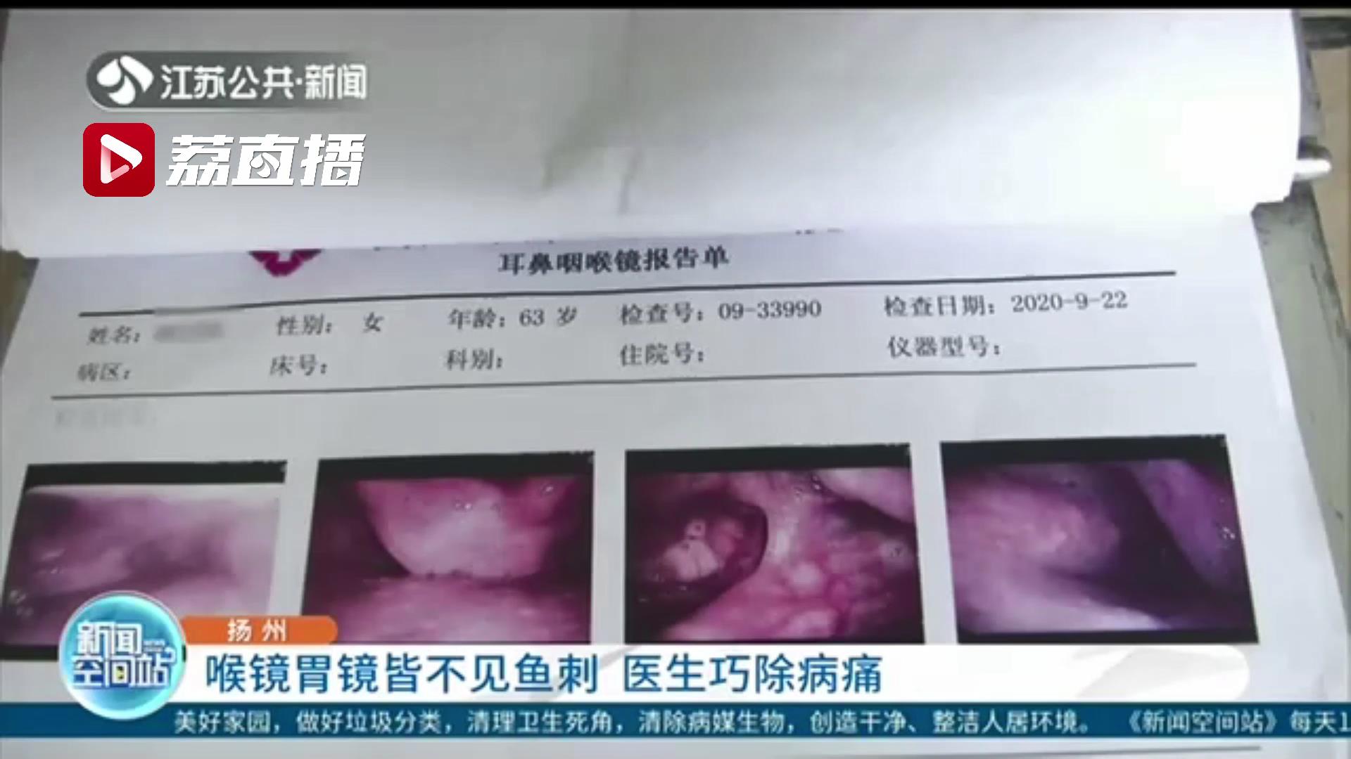 喉镜胃镜皆不见鱼刺 医生实施全麻手术进行“地毯式”排查