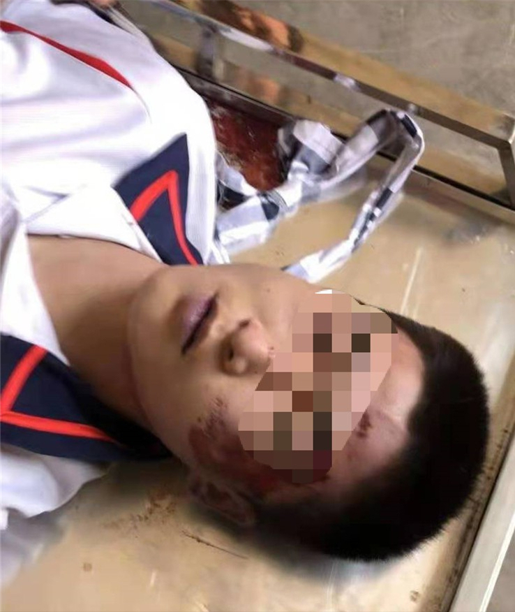 河北一16岁学生上吊自杀疑似遭到校园欺凌