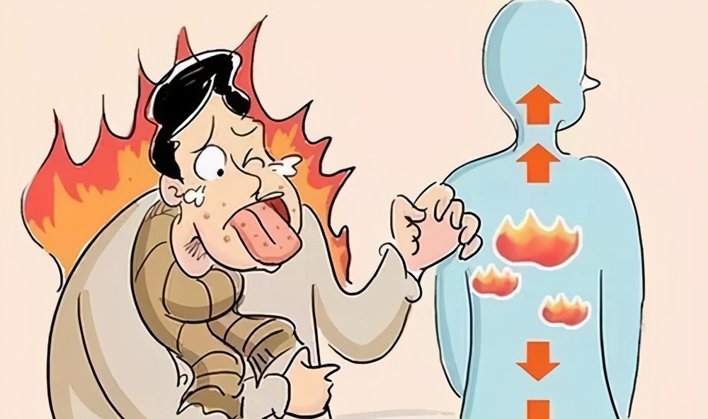 中医教你从舌像上来分辨体内的“火”