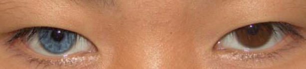 他們為何將眼球紋成黑色？瞳孔還有天生紅色？