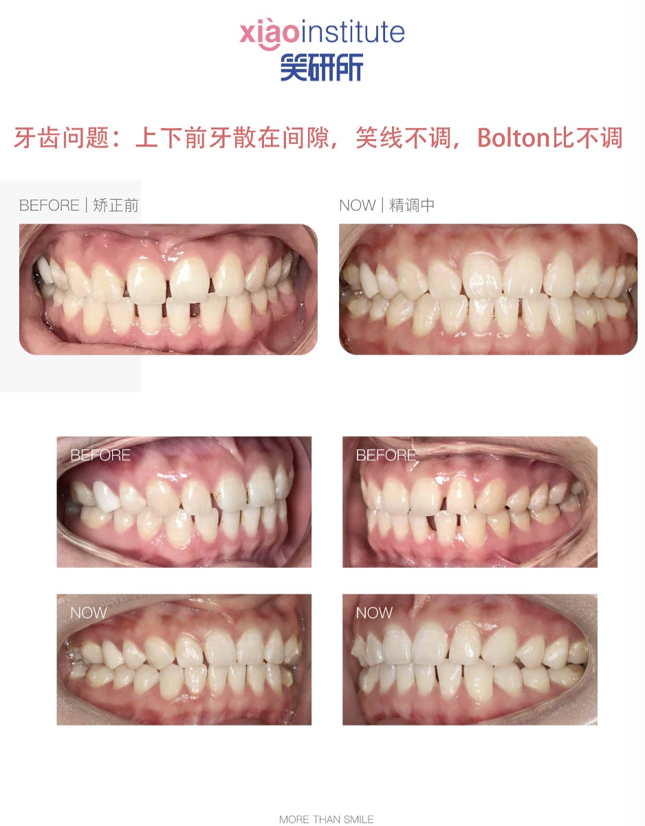 張雨綺新戀情曝光：“這次她看男人的眼光終于好了！”