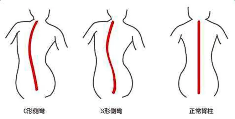 为什么一觉醒来会颈椎难受 原因是床垫没选对