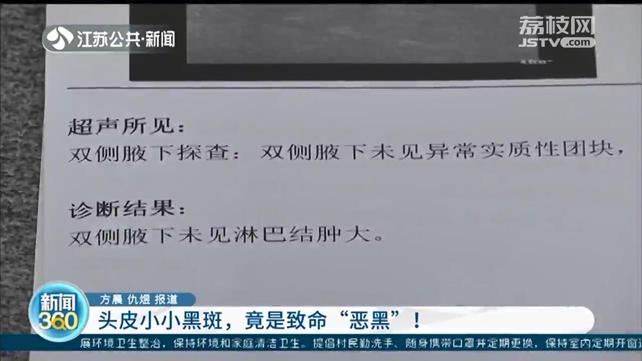 头皮黑斑变大，竟是致命恶性黑色素瘤！这些地方长“痣”要当心