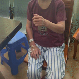 袁医生有话说脑起搏器手术(dbs)又称脑深部电刺激术,是目前治疗帕金森