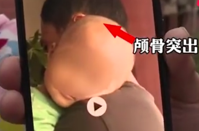 12年之后，我国再现大头娃娃事件，涉嫌方回应让