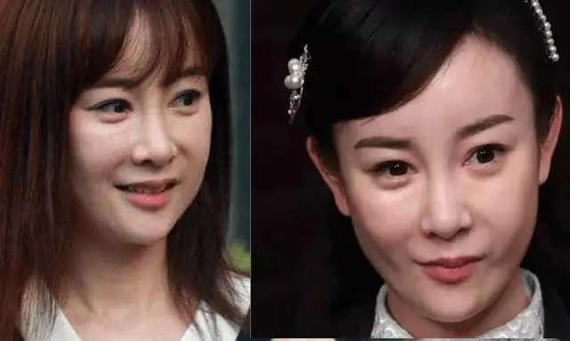 整容失败的10位明星，谁堪称“阴影”之最？