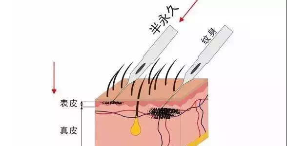 为什么要做半永久 一次纹眉 可睡2年懒觉 纹绣 橙子爱美丽整形信息综合网