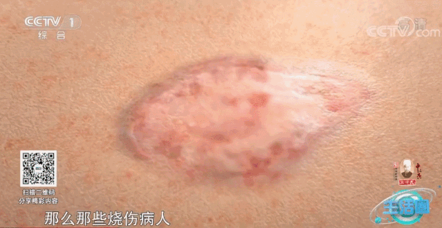 央视CCTV | 周琪院士：揭秘干细胞的神秘之处