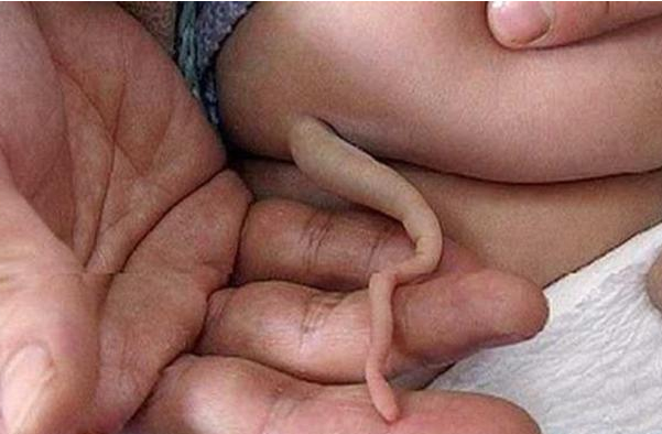 出现“返祖现象”？人类是进化还是退化？